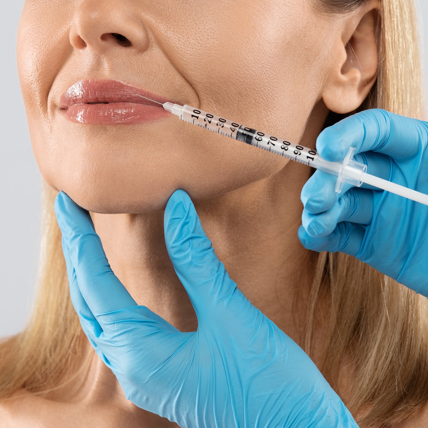 Filler Injections