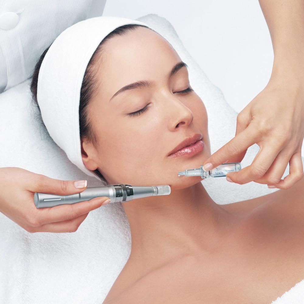 Microneedling