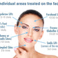 Neurotoxin Injections